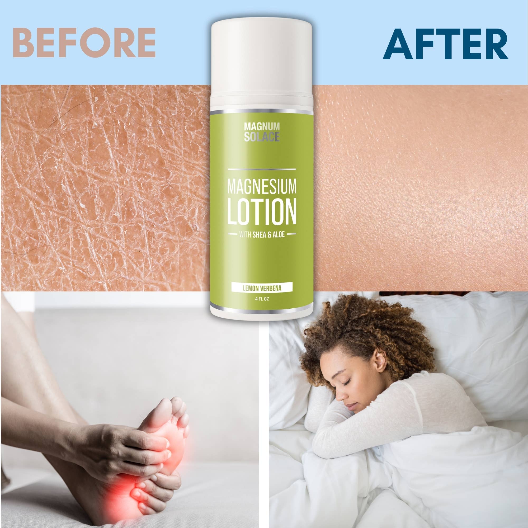 7421. Magnesium Lotion with Aloe, Shea and Coconut (Lemon Verbena)